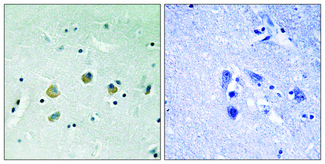 Anti-phospho-MAP3K8 (pSer???) antibody produced in