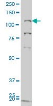 ANTI-GUCY2C antibody produced in mouse