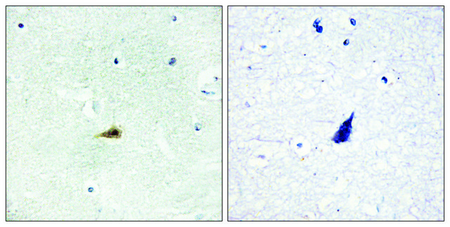 Anti-NCOR2 antibody produced in rabbit