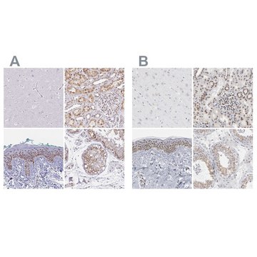 Anti-SYNE2 antibody produced in rabbit