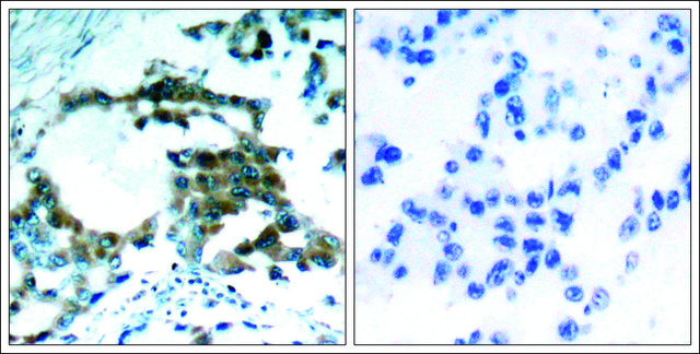 Anti-phospho-PRKCQ (pSer???) antibody produced in