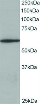 Anti-Coronin 1/TACO antibody produced in