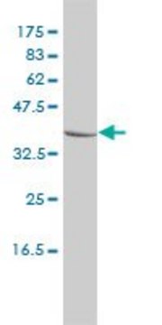 Monoclonal Anti-CTBS antibody produced in