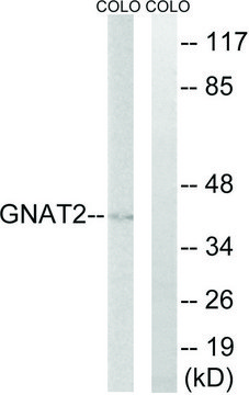 Anti-GNAT2 antibody produced in rabbit