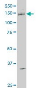 ANTI-ABL2 antibody produced in mouse