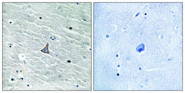 Anti-VHL antibody produced in rabbit