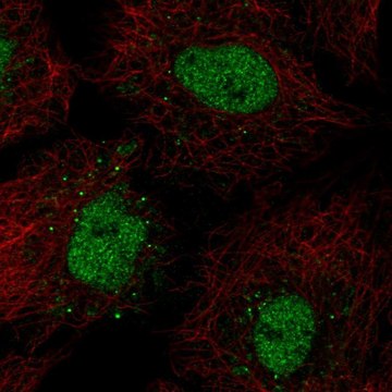Anti-BARX1 antibody produced in rabbit