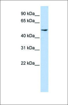 Anti-DCTN2 antibody produced in rabbit