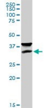 Anti-IFT57 antibody produced in rabbit