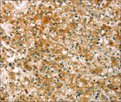 Anti-SLC40A1 antibody produced in rabbit