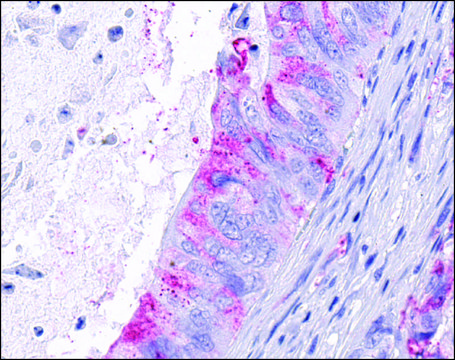 Anti-GPR124 antibody produced in rabbit