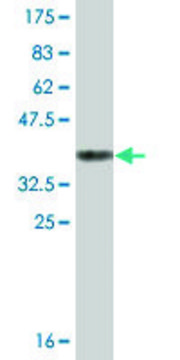 Monoclonal Anti-BHMT2, (N-terminal) antibody produced