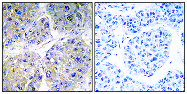 Anti-SLC27A5 antibody produced in rabbit