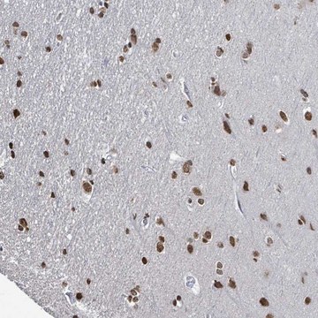 Anti-SAMD14 antibody produced in rabbit