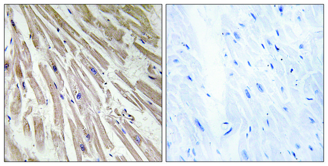 Anti-ARPP21 antibody produced in rabbit