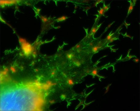 Phalloidin–Tetramethylrhodamine B isothiocyanate
