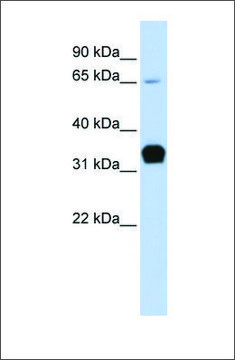 Anti-TNNT1 antibody produced in rabbit