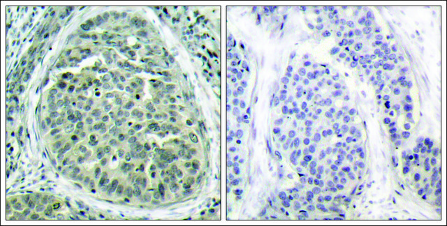 Anti-phospho-CTNNB1 (pSer³?) antibody produced in