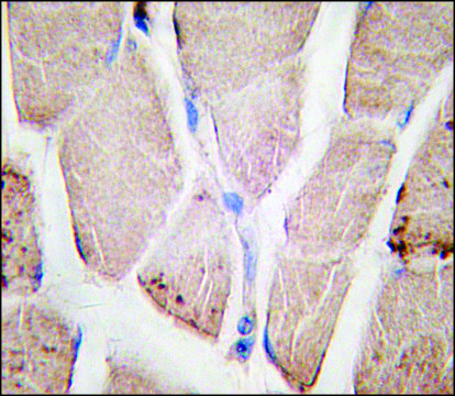 Anti-PYGM (C-term) antibody produced in