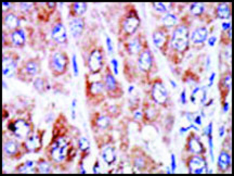 Anti-NME4 (N-term) antibody produced in
