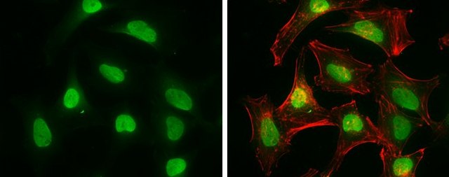 Monoclonal Anti-RBBP8 antibody produced in