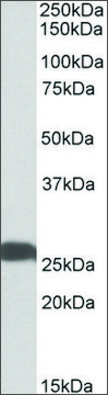 Anti-UCHL1 antibody produced in goat