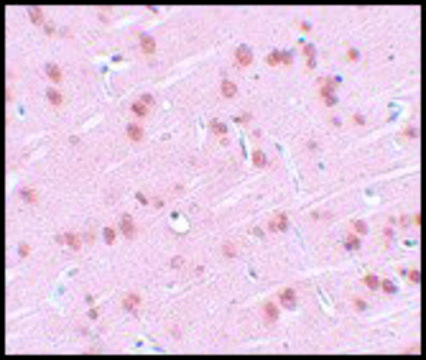 Anti-SYNGR1 antibody produced in rabbit