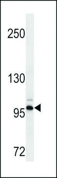 MONOCLONAL ANTI-DDR2 antibody produced in