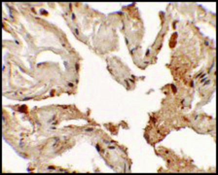 Anti-NKX2-1 antibody produced in rabbit