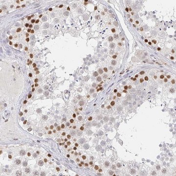 Anti-RCOR1 antibody produced in rabbit