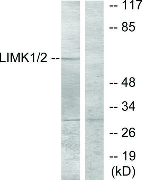 Anti-LIMK1 antibody produced in rabbit