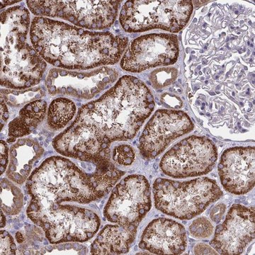 Anti-PPM1H antibody produced in rabbit