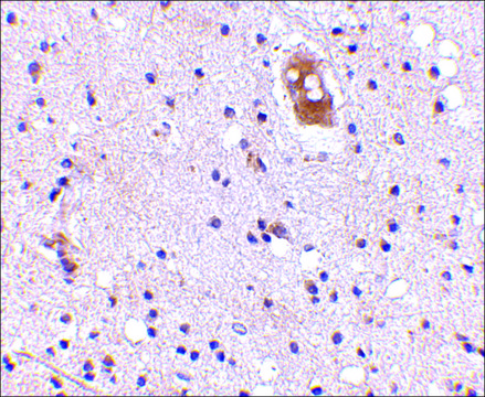 Anti-EVER2 (ab1) antibody produced in