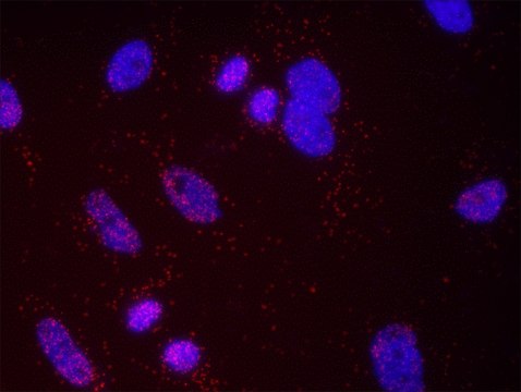SMARCA4 and Estrogen Receptor Alpha
