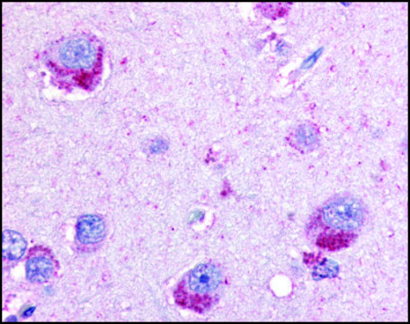 Anti-PYGB (AB1) antibody produced in