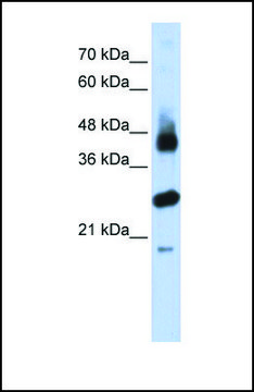Anti-FBXL2, (N-terminal) antibody produced in