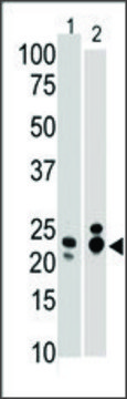Anti-ARF4L (N-term) antibody produced in