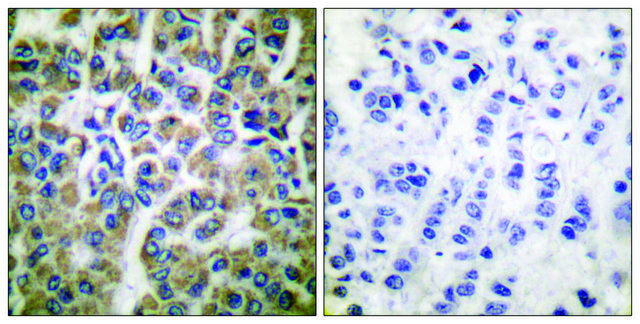 Anti-HSP10 antibody produced in rabbit