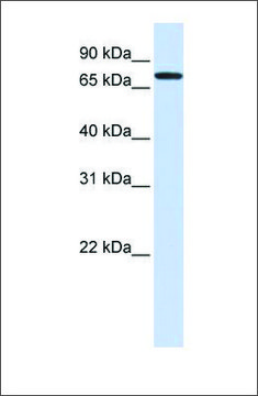 Anti-GALNT6 antibody produced in rabbit