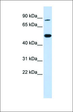 Anti-TRMT1 antibody produced in rabbit