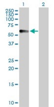 Anti-CPVL antibody produced in rabbit