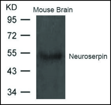 Anti-Neuroserpin antibody produced in rabbit