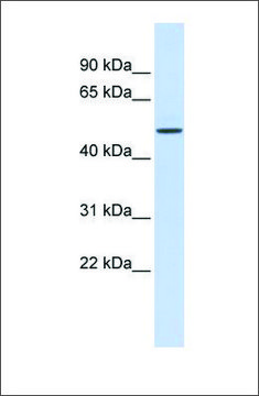 Anti-ELK4 antibody produced in rabbit