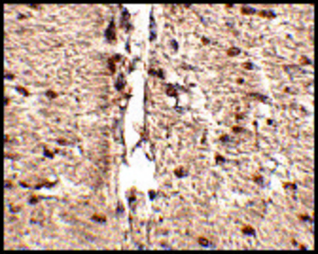 Anti-RKHD1 antibody produced in rabbit