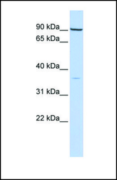 Anti-NKX2-5, (N-terminal) antibody produced in