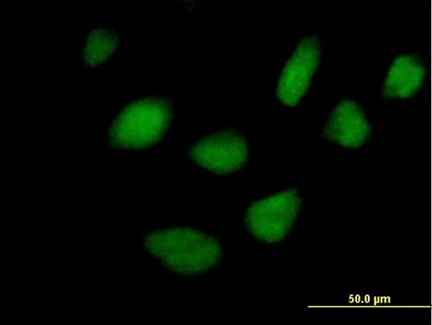 Anti-STK36 antibody produced in mouse