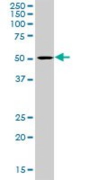 Anti-LIPA antibody produced in rabbit