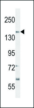 ANTI-CT117 (N-TERM) antibody produced in
