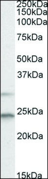 Anti-MAD2L1 (C-terminal) antibody produced in