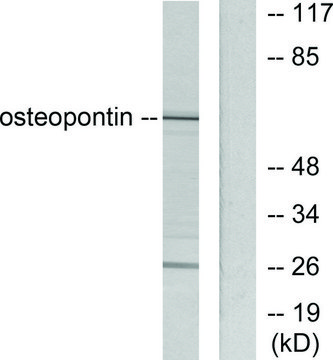 Anti-Osteopontin, C-Terminal antibody produced in